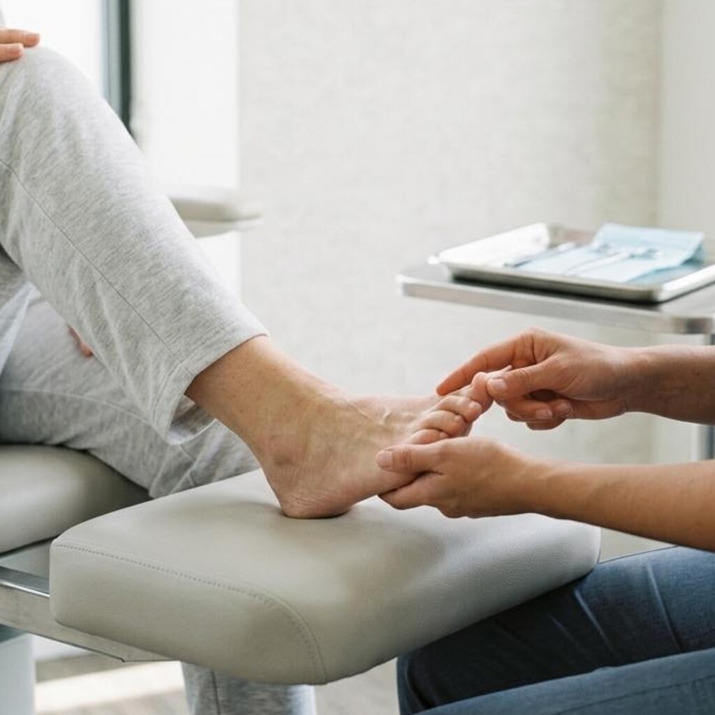 Clinical image illustrating Hammertoe
